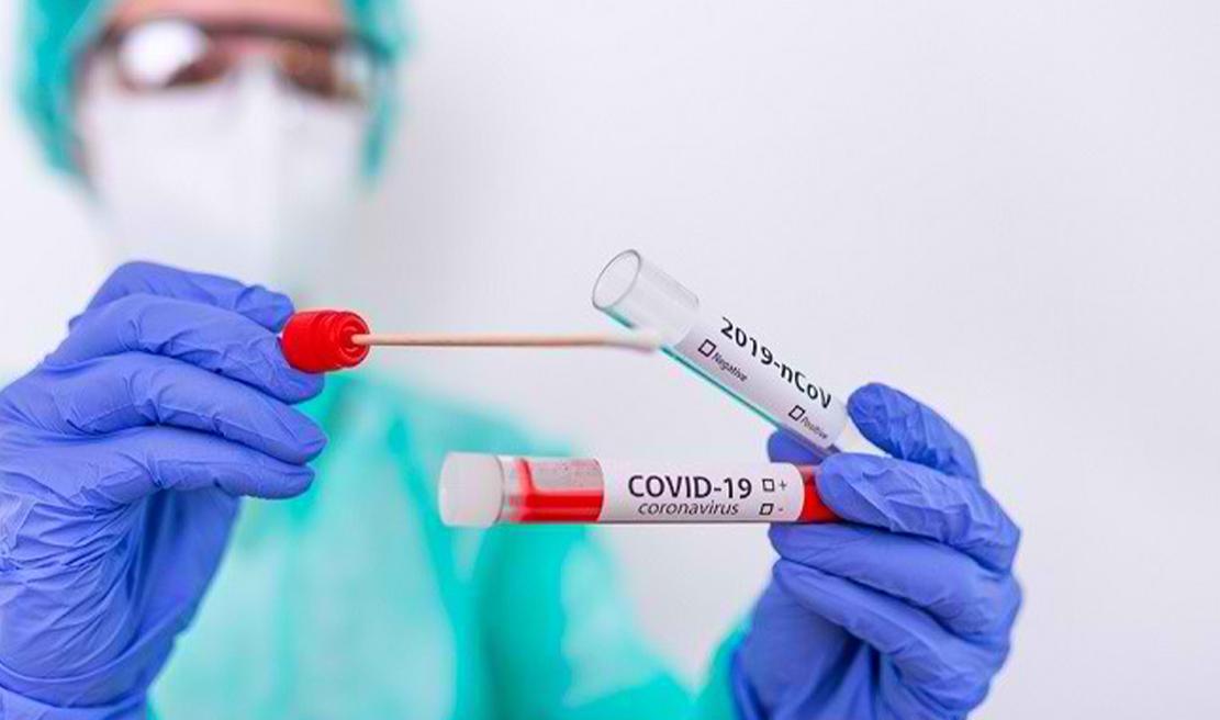 Memahami Perbedaan PCR, Rapid Test Antigen, dan Rapid Test Antibodi dalam Pemeriksaan COVID-19