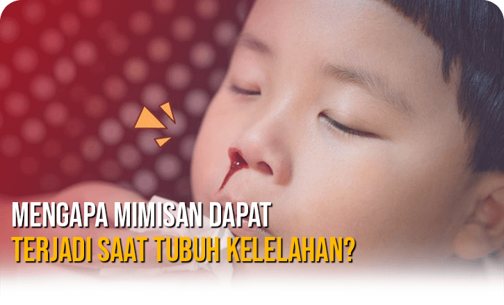 Mengapa Mimisan Dapat Terjadi Saat Tubuh Kelelahan